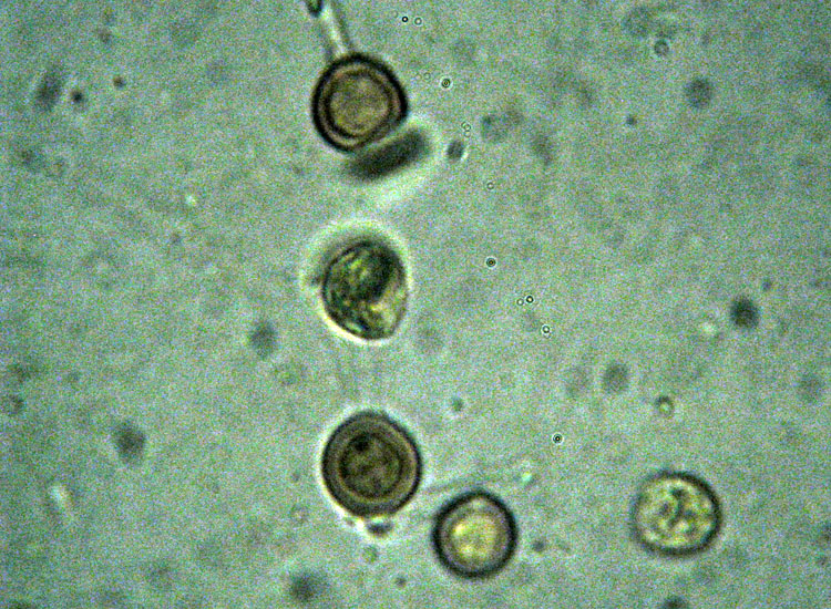 In parcheggio (Granulobasidium vellereum)